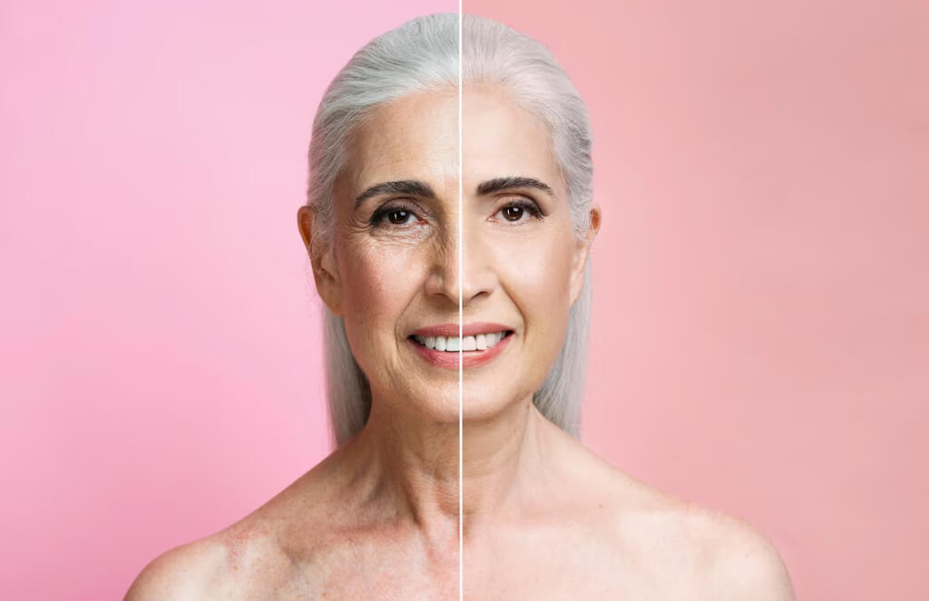 anti-aging-1 - MidyDove Fashion Store Anti Aging Before and After